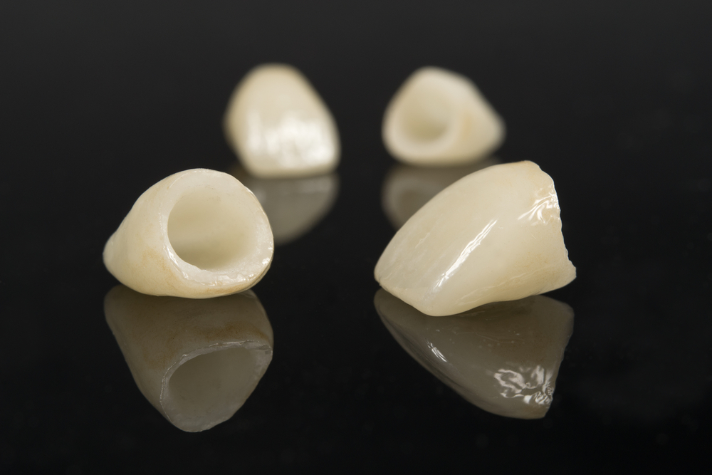 Restauraciones dentales sin metal