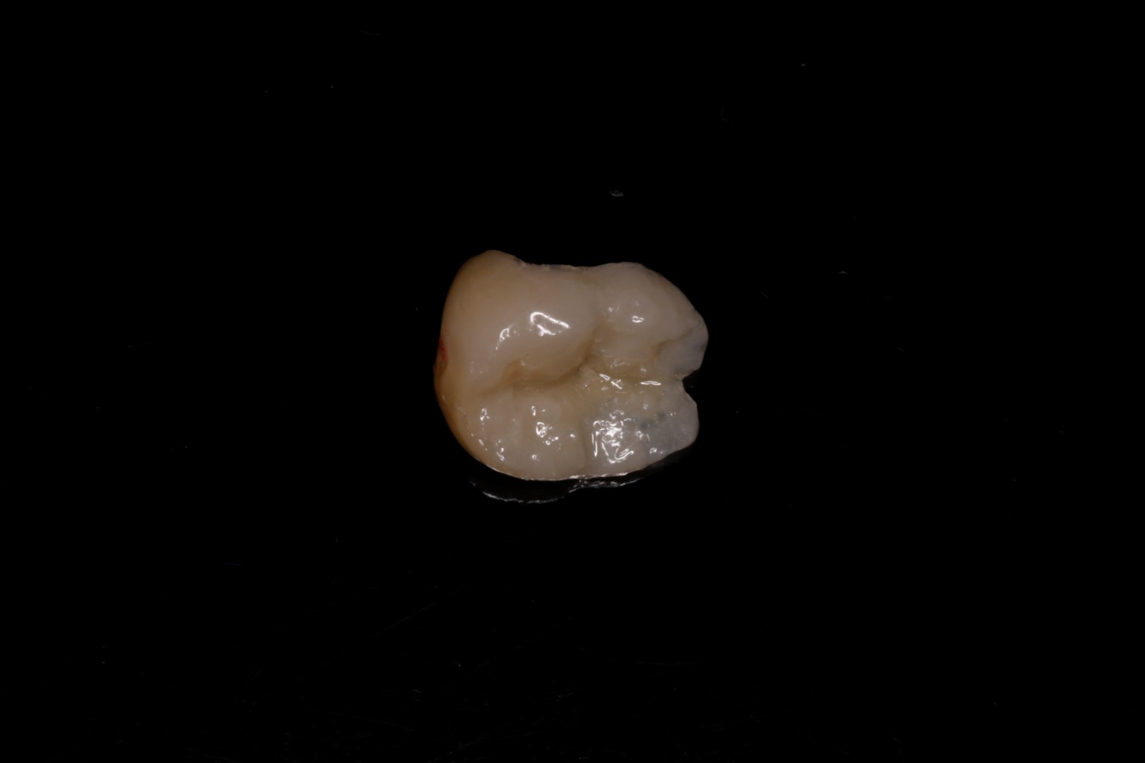 Fotografía relacionada con rehabilitaciones fijas sobre implantes