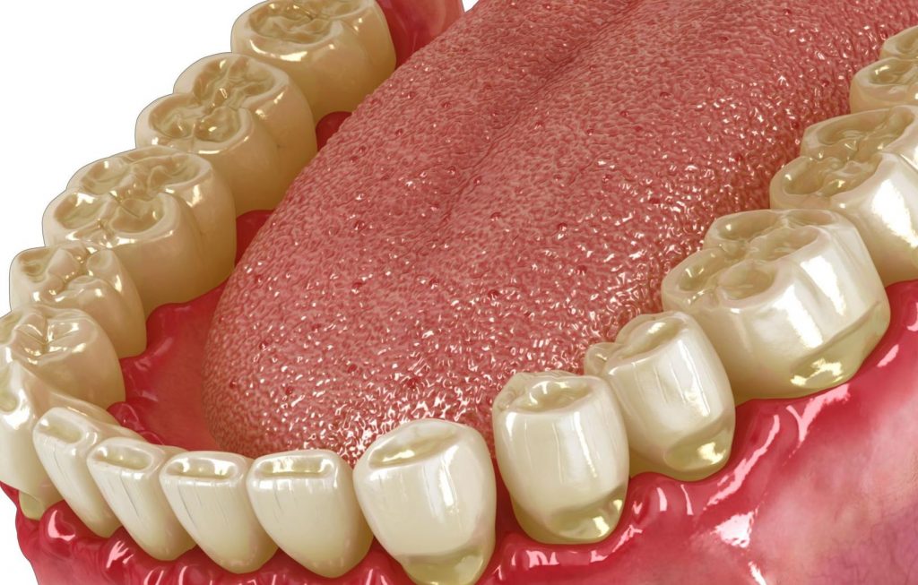 Desgaste dental relacionado con el bruxismo