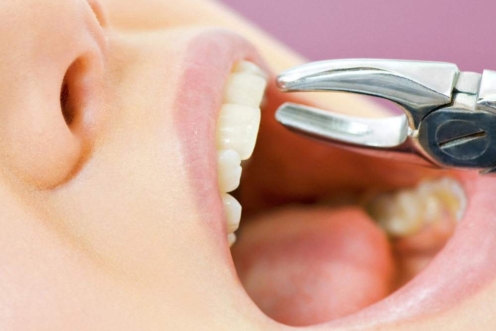 Fotografía relacionada con cirugía oral