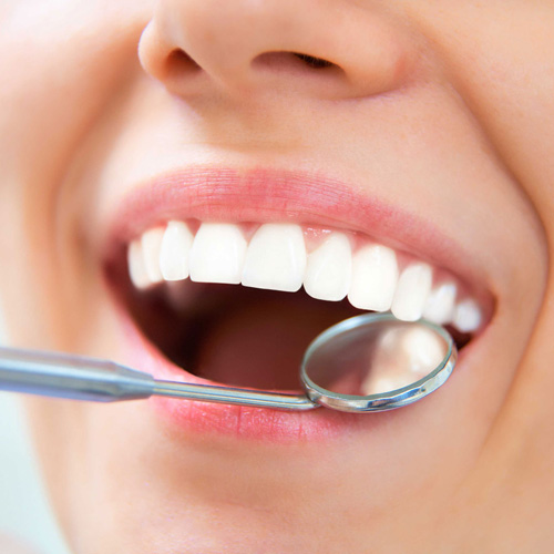 Tratamiento de mantenimiento de implantes