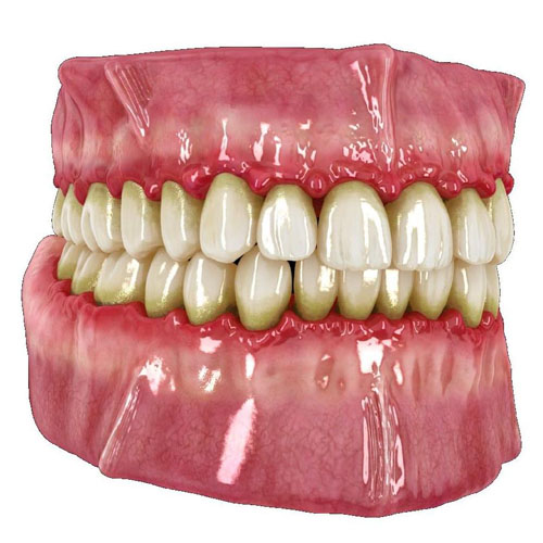 Fotografía relacionada con periodoncia y salud de las encías