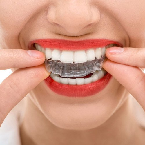 Fotografía de ortodoncia dental